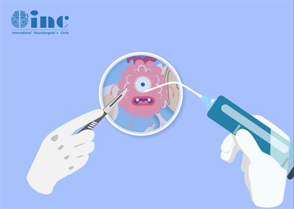 腦部海綿狀血管瘤輕微出血會自愈嗎?多久再次出血?