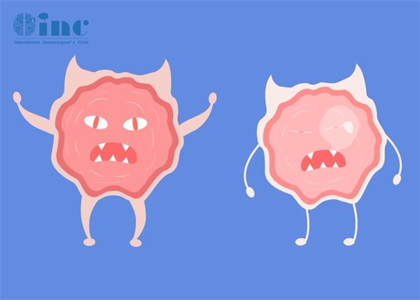 4毫米的良性腦膜瘤，是否嚴(yán)重？