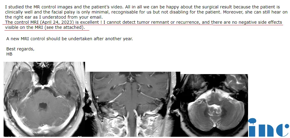 聽神經瘤暖心故事：高齡老人，不懼開顱，只為陪老伴走好未來的每一天