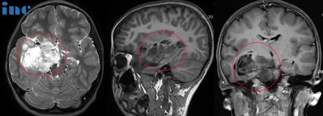 “想辦法找到實(shí)力、經(jīng)驗(yàn)更強(qiáng)的醫(yī)生”