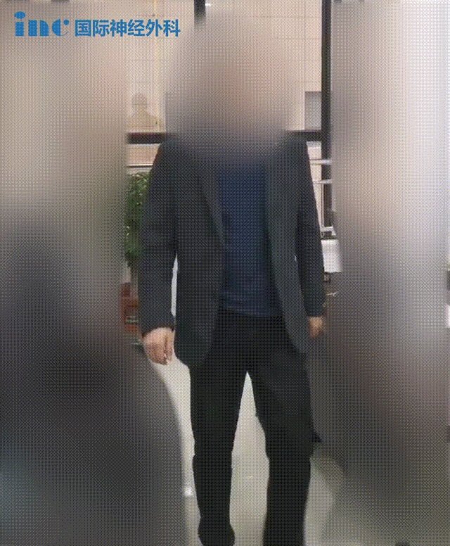 32歲腦干-延髓海綿狀血管瘤案例：腦干術(shù)后要多久能走能跑？