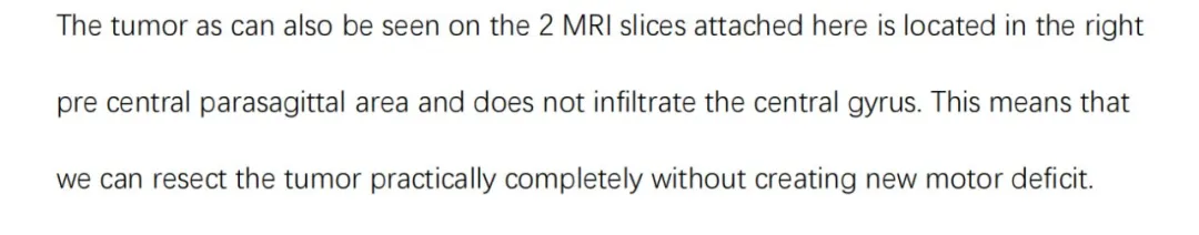 巴教授評估意見表示腫瘤位于右側(cè)中央前-失狀竇旁區(qū)，沒有浸潤到中央腦回。這意味著我們實際上可以切除腫瘤，而不會造成新的運動功能障礙。