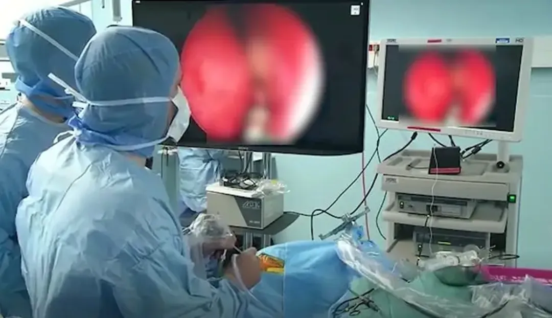 利用鼻孔作為內(nèi)鏡和吸引器的支點，在鼻腔狹窄的空間，我們只需要用手指輕輕的夾持和引導內(nèi)鏡的移動