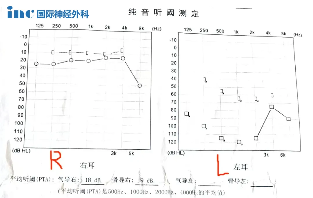患者術(shù)前癥狀