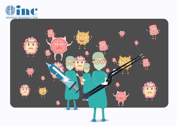 松果體母細胞瘤四級能活多久?