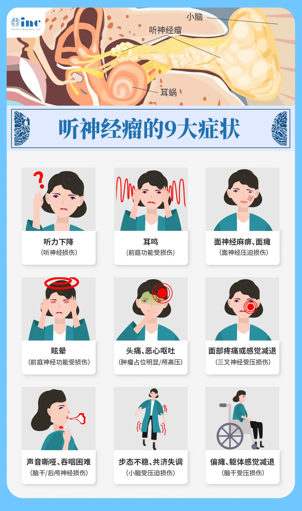 早期最常見的癥狀包括：同側(cè)感音神經(jīng)性聽力下降；不對稱耳鳴、面癱、頭暈、眩暈；走路不平衡……而如果未及時(shí)發(fā)現(xiàn)、未進(jìn)行治療，中晚期則會(huì)出現(xiàn)肢體癱瘓、吞咽困難等。