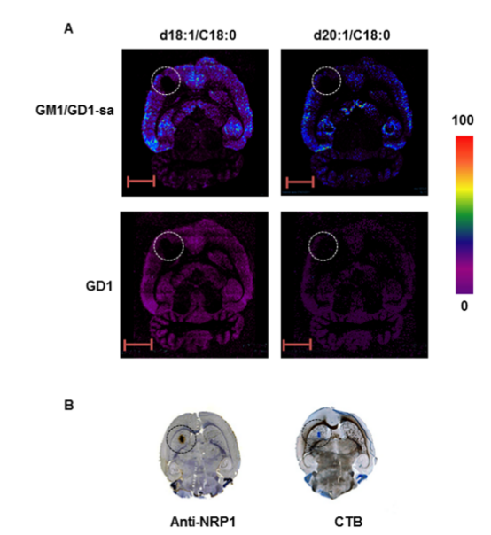 圖2 大鼠膠質(zhì)瘤顱內(nèi)同種異體移植中的GM1和GD1的MALDI-MSI分析。(A) GM1/GD1-唾液酸（[M-H]?）d18:1（m/z 1545）和20:1（m/z 1573）、GD1（[M+Na-2H]?）d18:1（m/z 1874）和20:1（m/z 1886）的MSI。離子強(qiáng)度根據(jù)提供的強(qiáng)度尺度以顏色表示。(B) 通過CTB和抗NRP1抗體分別對GM1和NRP-1進(jìn)行免疫染色，顯示大鼠膠質(zhì)瘤顱內(nèi)同種異體移植中的分布。圓圈指示異種移植的位置。比例尺：5毫米。GD1-sa = GD1-唾液酸。