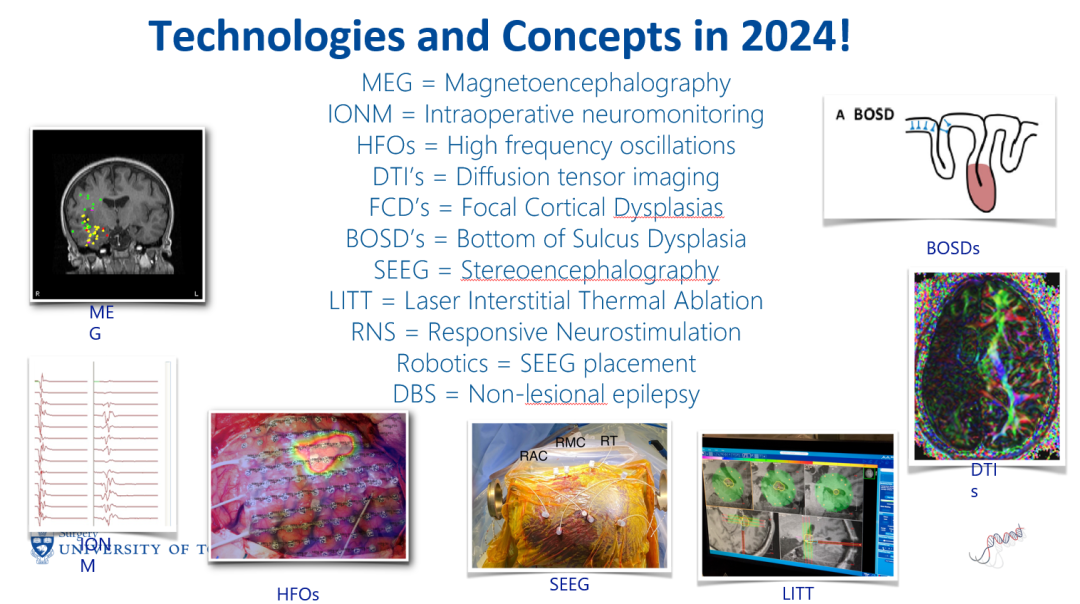 激光間質(zhì)熱療（LITT）、腦磁圖（MEG）、高頻振蕩（HFO’s）及反應性神經(jīng)刺激（RNS）、立體定位腦電波電極放置術(shù)（SEEG）等。