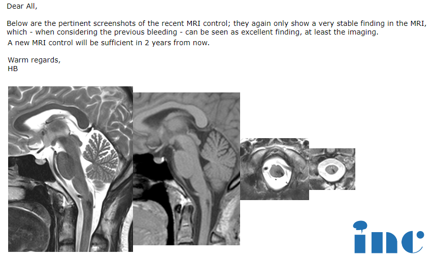巴教授術(shù)后2年隨訪郵件截圖