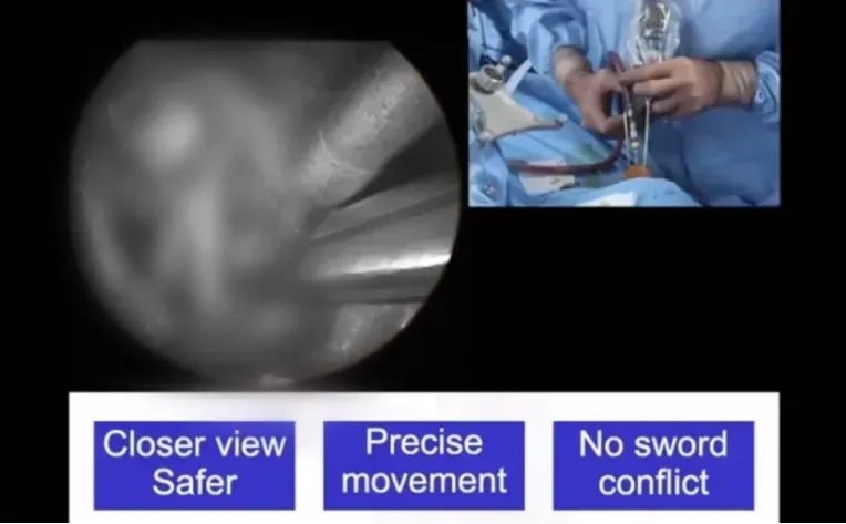 操作時(shí)，移動(dòng)非常精確的，實(shí)際上我并不是在用雙手操作。那么我雖然不能用雙手操作，但是我另一側(cè)是穩(wěn)定的。