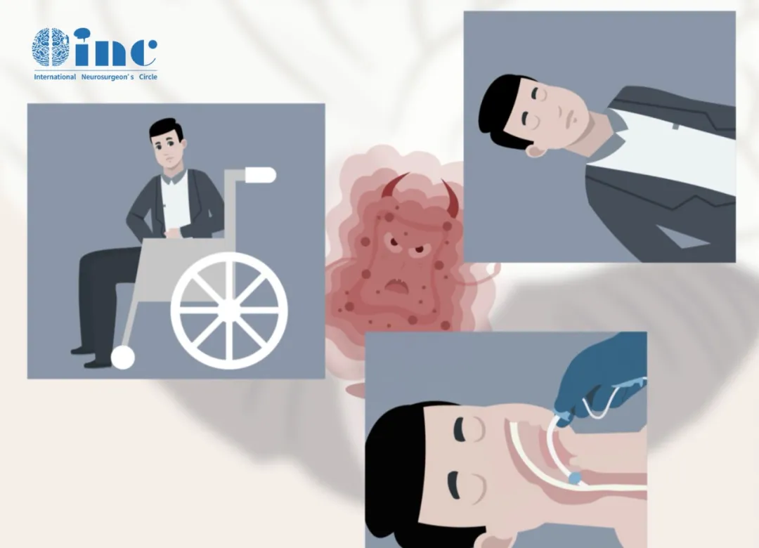 腦干海綿狀血管瘤再次突發(fā)出血