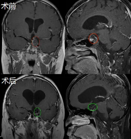 當(dāng)一個(gè)與腦瘤「共存」15年的男孩決定做個(gè)了斷……