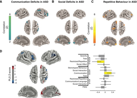 小腦緘默綜合征與自閉癥