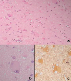 圖3代表性組織病理圖像：