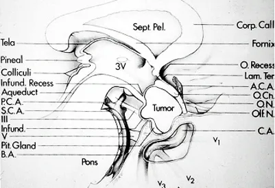 分類：基于不同體系