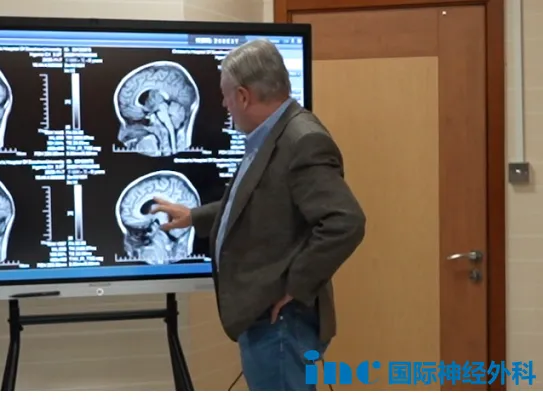 “一切為了孩子！”疑難腦瘤家庭期盼中，INC巴教授示范手術(shù)繼續(xù)