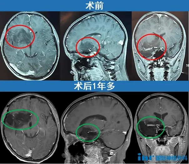 術(shù)前術(shù)后影像資料