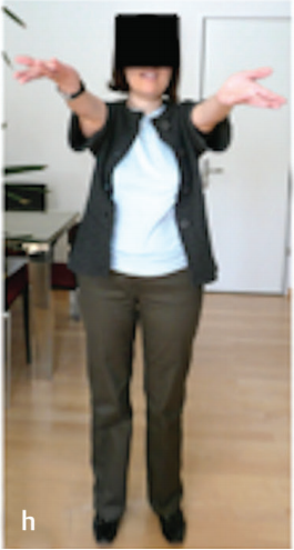 腦干膠質(zhì)瘤案例