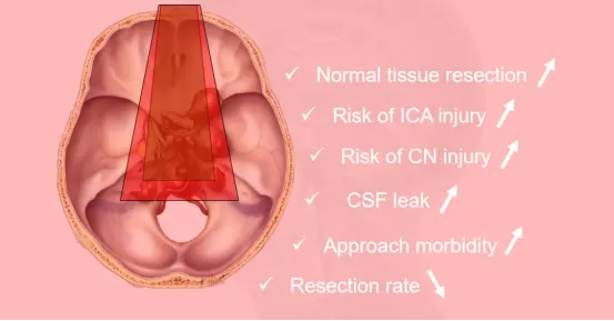 垂體瘤手術(shù)真的“簡(jiǎn)單”嗎？